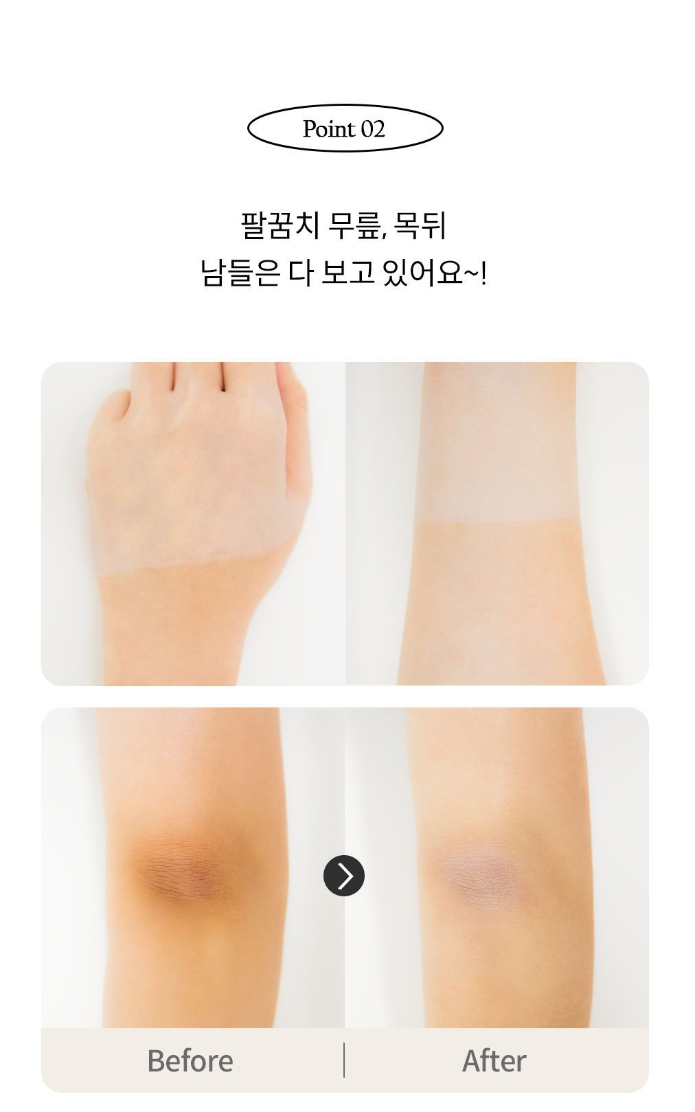 팔꿈치 무릎 목뒤 바디에도 사용