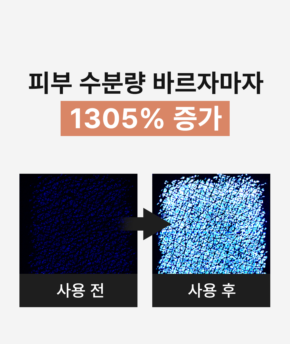 피부 수분량 1305프로 증가